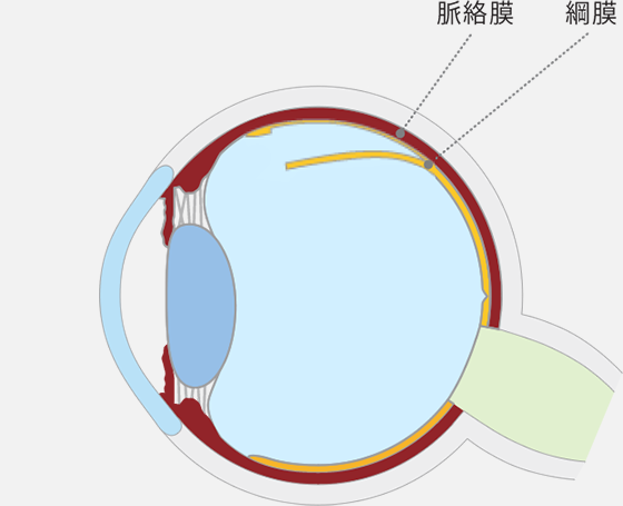 網膜が剥がれる