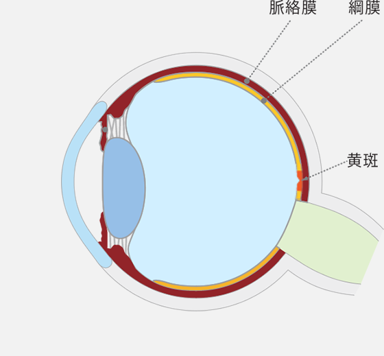 加齢黄斑変性