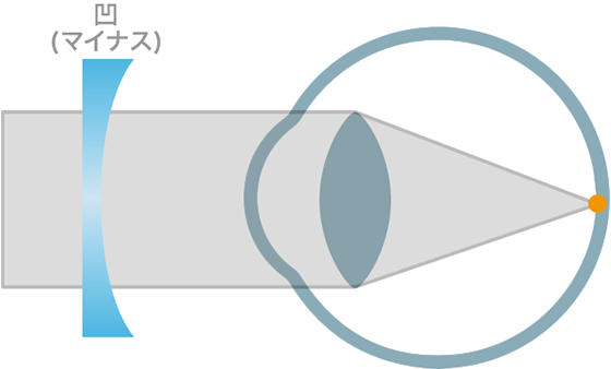 図解:メガネレンズによる補正