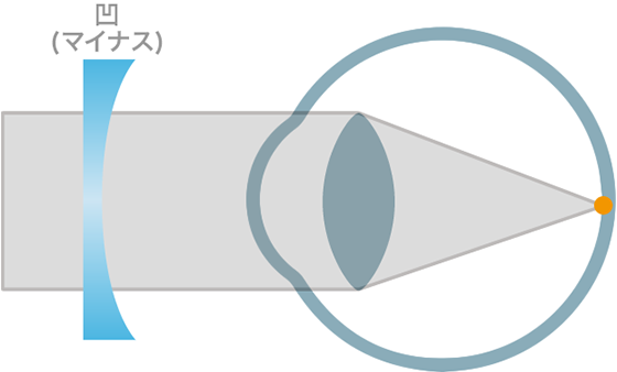 図解：メガネレンズによる補正