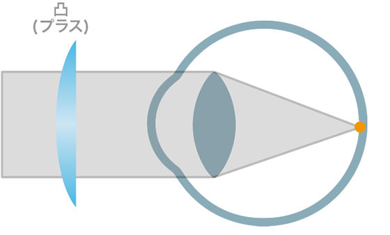 図解：メガネレンズによる補正