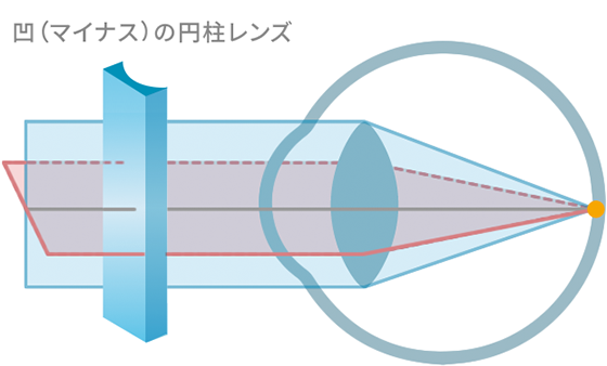 メガネレンズによる補正