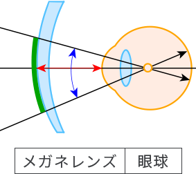 外面累進レンズ レンズのイメージ（横から見た図）