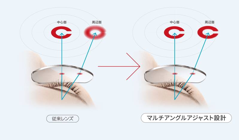 マルチアングル アジャスト設計