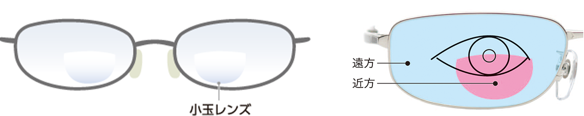 小玉レンズ