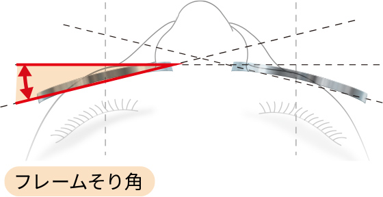 フレームそり角