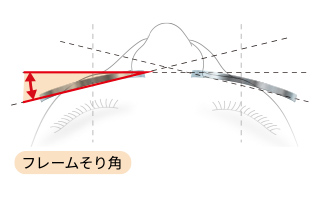 フレームそり角