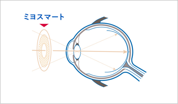 ミヨスマートによる補正